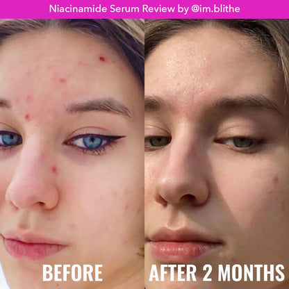 Good Molecules Niacinamide Serum 30 ml