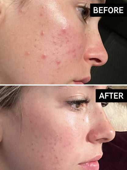 Inkey list Mandelic Acid Treatment 15 ml