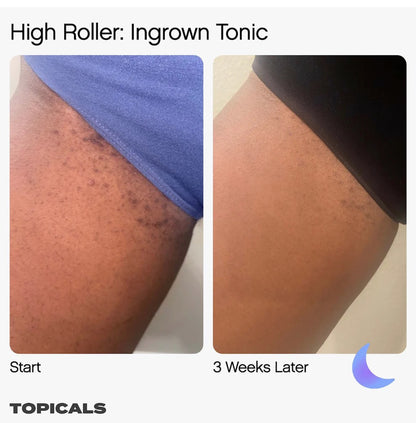 Topicals High Roller Ingrown Tonic 50 ml