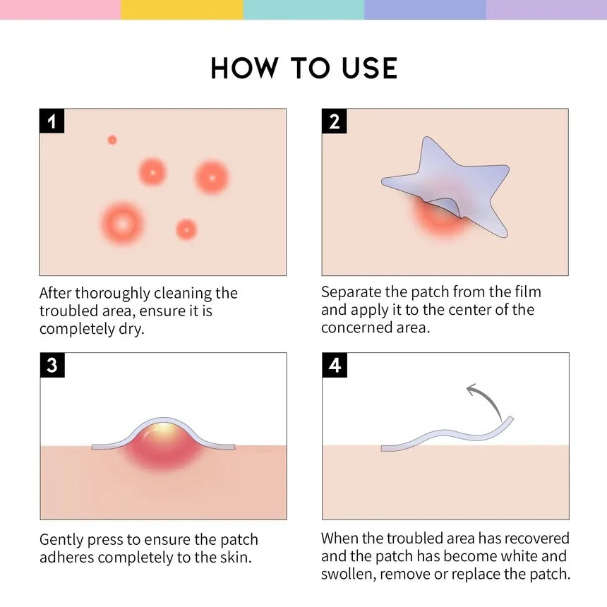 OOTD - Star Spot Pimple Patch [80 patches in Pack ]