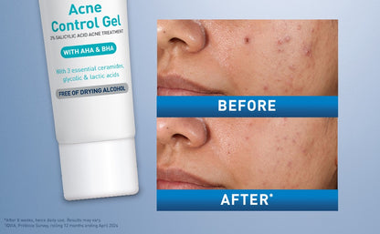 Cerave Acne Control Gel 40 ml