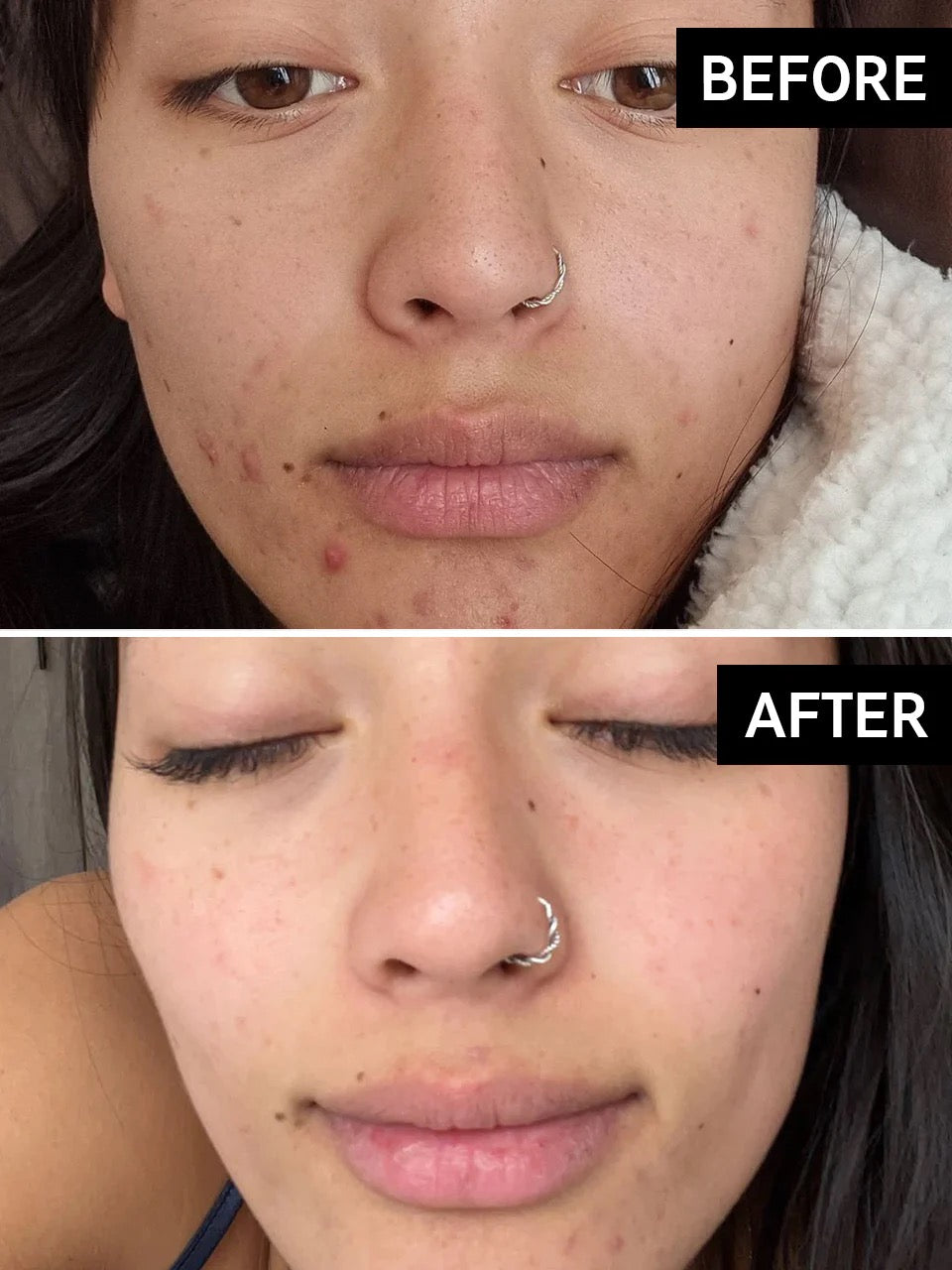 Inkey List Salicylic Acid Cleanser