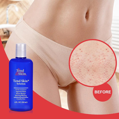 TEND SKIN Solution 4 Fl Oz