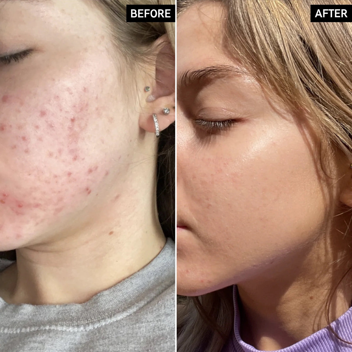 Inkey List Niacinamide 30ml