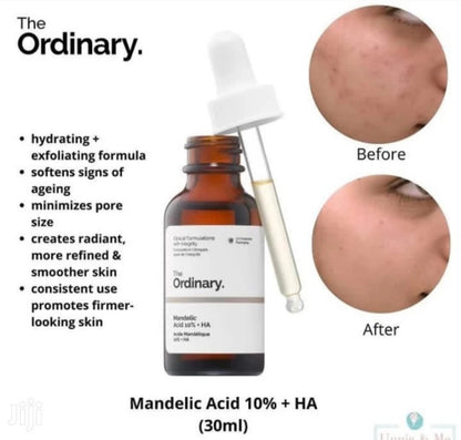 The Ordinary Mandelic Acid 10% + HA 30ml
